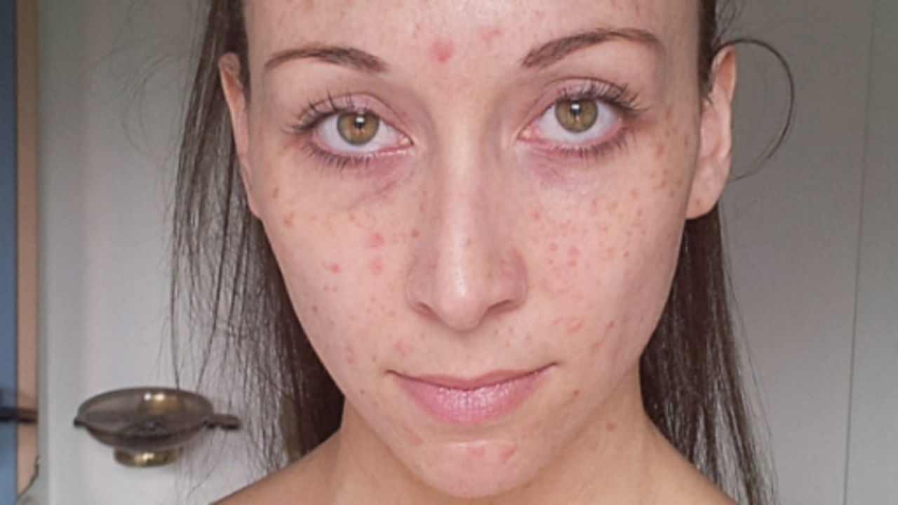 billigt melanotan